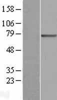 FATP3 (SLC27A3) Human Over-expression Lysate