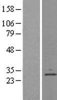 DERL1 Human Over-expression Lysate