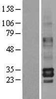 TPSB2 Human Over-expression Lysate