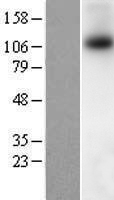 TRPM8 Human Over-expression Lysate