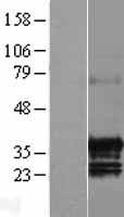 C17ORF39 (GID4) Human Over-expression Lysate