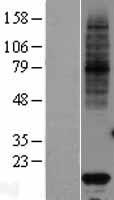 VKORC1 Human Over-expression Lysate