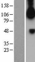 FGFR1 Human Over-expression Lysate