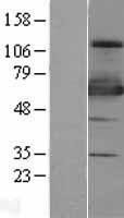 ZNF447 (ZSCAN18) Human Over-expression Lysate