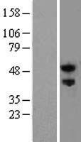 Nogo Receptor (RTN4R) Human Over-expression Lysate