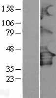 P2Y12 (P2RY12) Human Over-expression Lysate