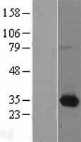 NMNAT1 Human Over-expression Lysate