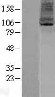 ARV1 Human Over-expression Lysate