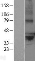 LPPR2 (PLPPR2) Human Over-expression Lysate