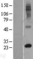 RTP4 Human Over-expression Lysate