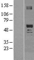 OXCT2 Human Over-expression Lysate