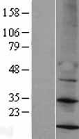 MRPS14 Human Over-expression Lysate