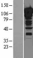 ZNF148 Human Over-expression Lysate