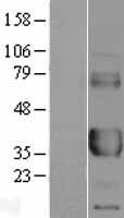 CD32A (FCGR2A) Human Over-expression Lysate
