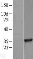 TICAM2 Human Over-expression Lysate