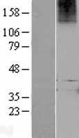 LGR7 (RXFP1) Human Over-expression Lysate
