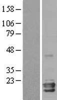Neuroglobin (NGB) Human Over-expression Lysate