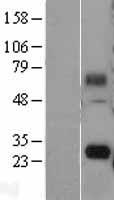 SINHCAF Human Over-expression Lysate