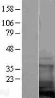 COTL1 Human Over-expression Lysate