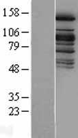 KDM6A Human Over-expression Lysate