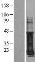 GAGE7 Human Over-expression Lysate
