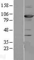 SAP102 (DLG3) Human Over-expression Lysate
