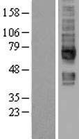 SLC5A6 Human Over-expression Lysate