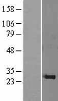 PSF1 (GINS1) Human Over-expression Lysate