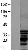 PDLIM1 Human Over-expression Lysate