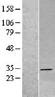 DHRS4 Human Over-expression Lysate