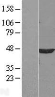 PPM1A Human Over-expression Lysate