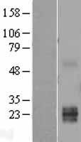 TWSG1 Human Over-expression Lysate