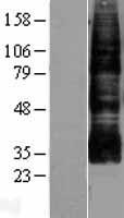 Aquaporin 9 (AQP9) Human Over-expression Lysate