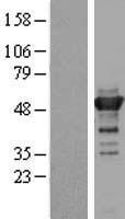 KIAA1609 (TLDC1) Human Over-expression Lysate