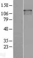 USP37 Human Over-expression Lysate