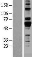 AMIGO1 Human Over-expression Lysate