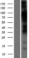 STIM2 Human Over-expression Lysate