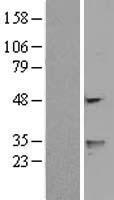 FENS1 (WDFY1) Human Over-expression Lysate