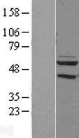 PDP2 Human Over-expression Lysate