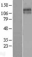 KCC2 (SLC12A5) Human Over-expression Lysate