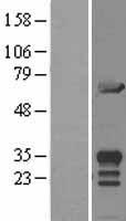 MIF4GD Human Over-expression Lysate