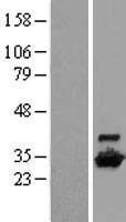 DCUN1D1 Human Over-expression Lysate