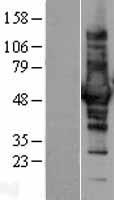 CORO1B Human Over-expression Lysate