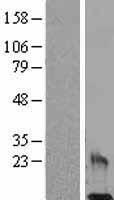 Resistin (RETN) Human Over-expression Lysate