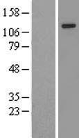 Zinc finger MIZ domain containing protein 1 (ZMIZ1) Human Over-expression Lysate