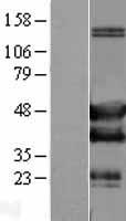 SH3GLB2 Human Over-expression Lysate
