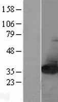 NIT2 Human Over-expression Lysate