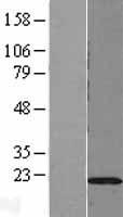 DUSP22 Human Over-expression Lysate