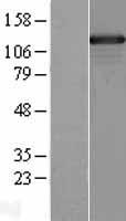 SMARCAD1 Human Over-expression Lysate