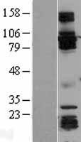 GRASP1 (GRIPAP1) Human Over-expression Lysate